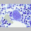 Medula osea SF 13.jpg